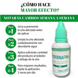 ADIOS A LOS HONGOS: TERBINAFINA EN GOTAS PARA TUS UÑAS