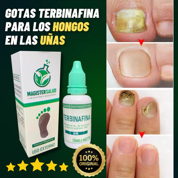 ADIOS A LOS HONGOS: TERBINAFINA EN GOTAS PARA TUS UÑAS