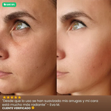 INFIBELLA®️ - Crema antiedad con Sangre de Dragón